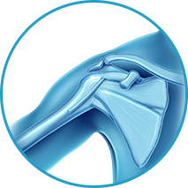Shoulder Joint Products