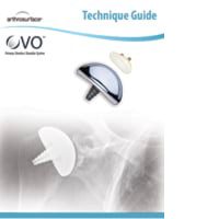 OVO/Glenoid Total Shoulder Tech Guide