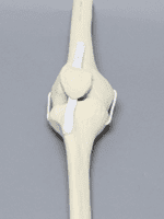 Full Knee Sawbone