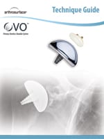 OVO Stemless Total Shoulder W/ Glenoid Tech Guide