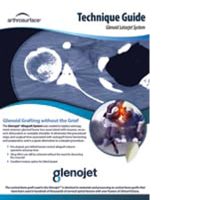 Glenojet Tech Guide