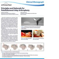 PF Inlay Arthroplasty Clinical Monograph