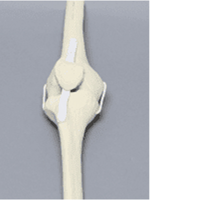 Full Knee Sawbone LEFT - Anika Therapeutics