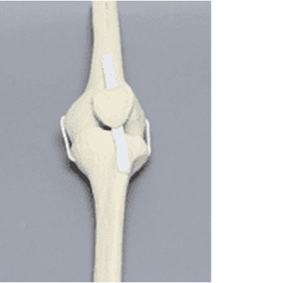 Full Knee Sawbone RIGHT - Anika Therapeutics