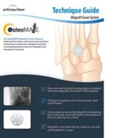 OsteoMate Foot Tech Guide