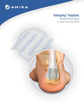 Integrity Achilles Tendon Repair Surgical Technique Guide cover