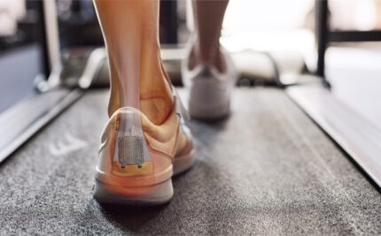 back of foot with xray look at the achilles tendon in ankle