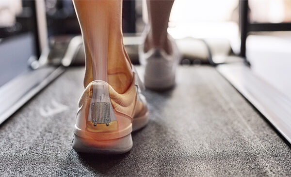 back of foot with xray look at the achilles tendon in ankle