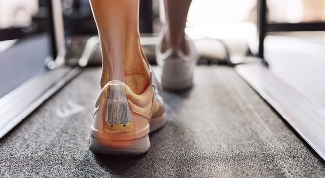 back of foot with xray look at the achilles tendon in ankle