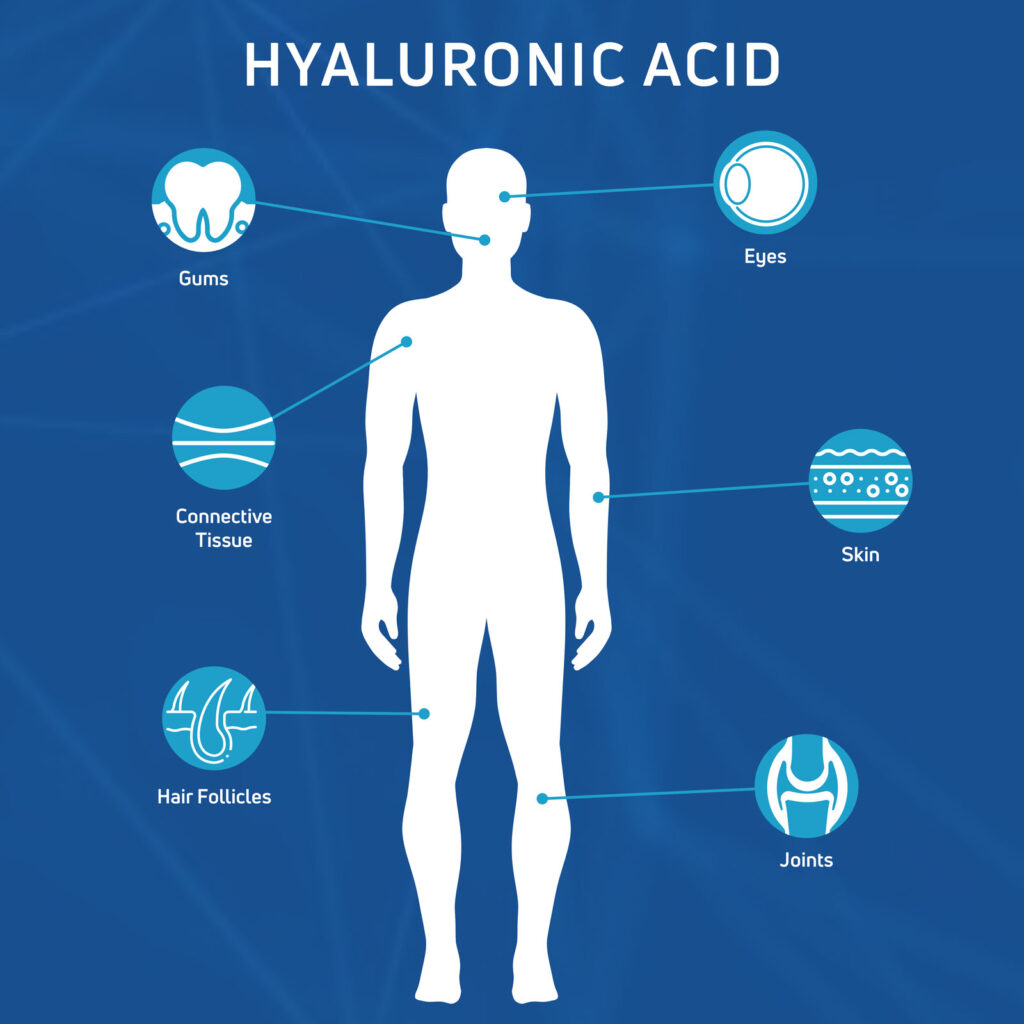 Diagram showing human body silhouette with labeled areas where hyaluronic acid is found: eyes, gums, skin, connective tissue, joints, and hair follicles.