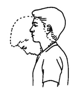 Neck Flexion Neck Flexion