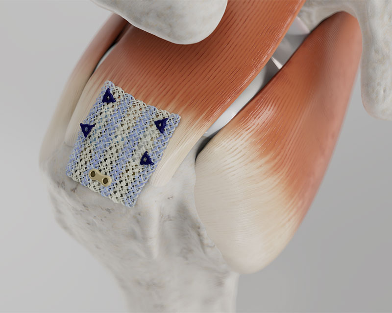 Gloved hands holding a flexible electronic device with a grid pattern of blue sensors on a bendable surface.