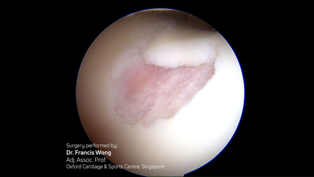 Clinical Applications in Specific Patient Groups: