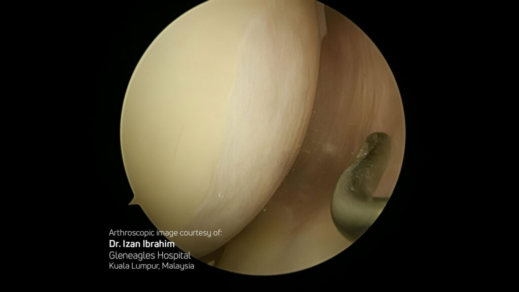 Quality of Regenerated Tissue: