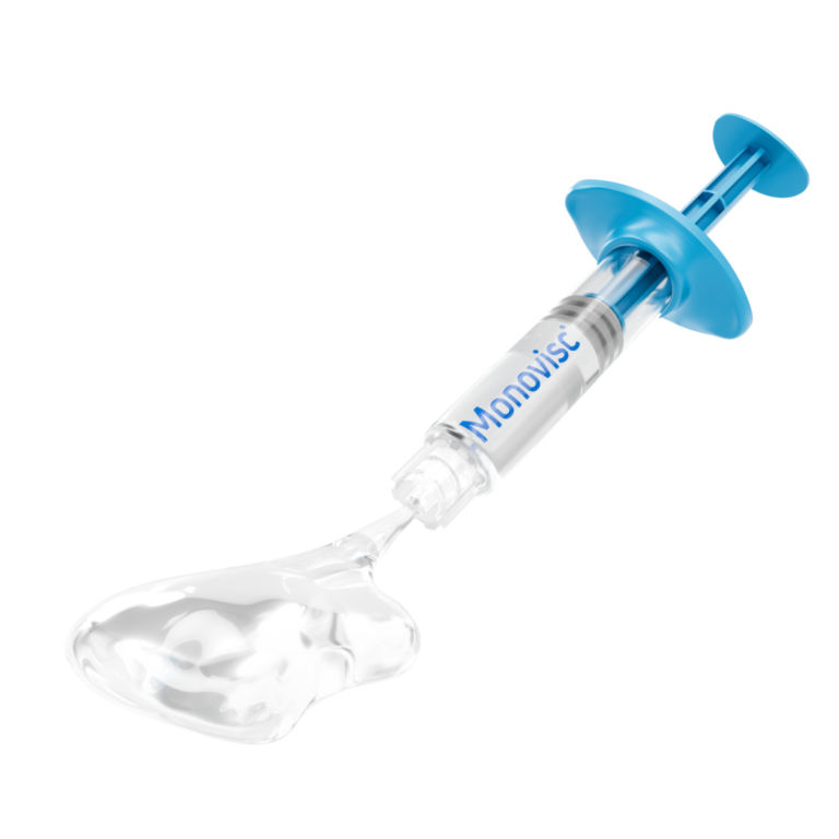 Medical syringe with blue components and "MONOVISC" label, containing clear liquid for injection.