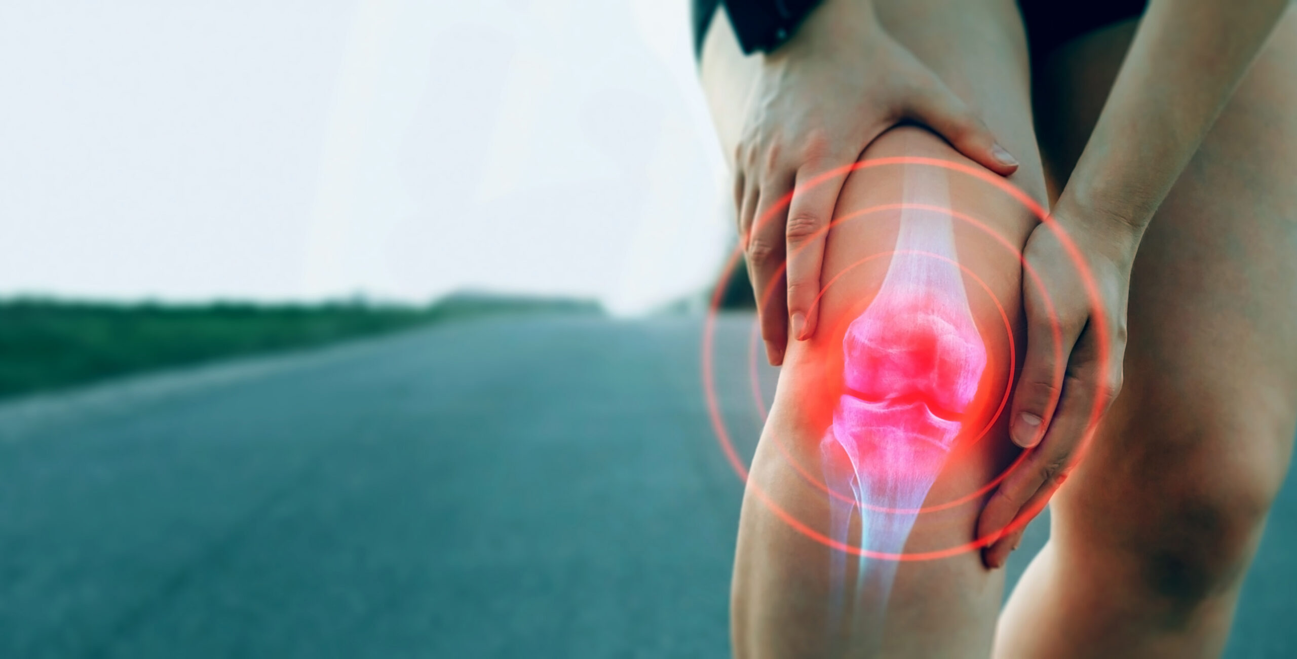 Joint problems and tendon inflammation. Sporty woman who suffered a knee accident during the run.